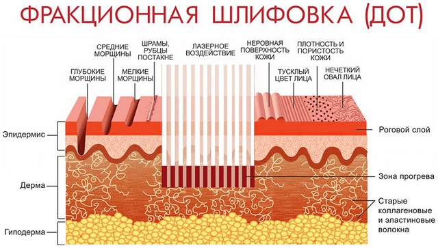 как работает дот омоложение