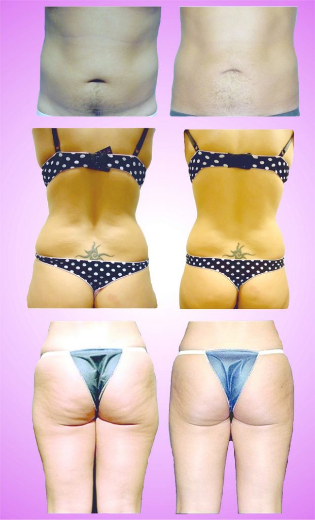 ���������� �������� ������ ���� �� � ����� ������ ��������