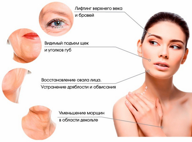 Эффективность векторного лифтинга лифтинг лица