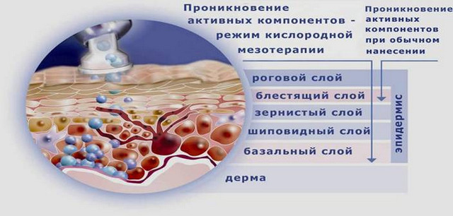 как действует кислородная мезотерапия