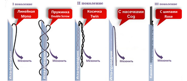 типы нитей для лифтинга