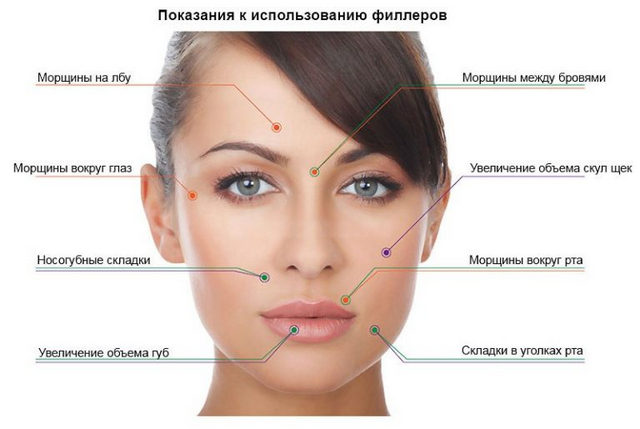 показания к применению филлеров