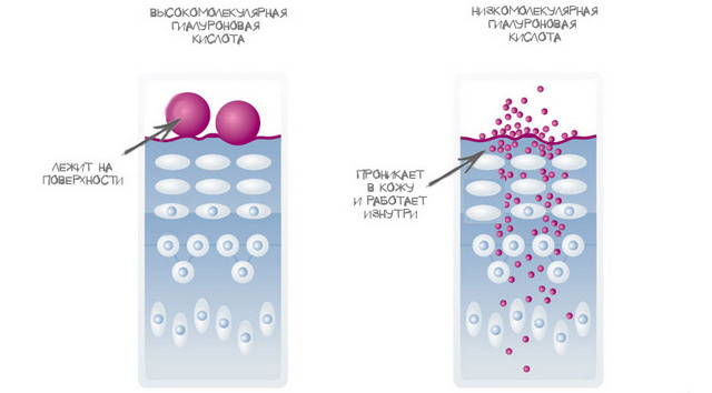 Виды гиалуроновой кислоты