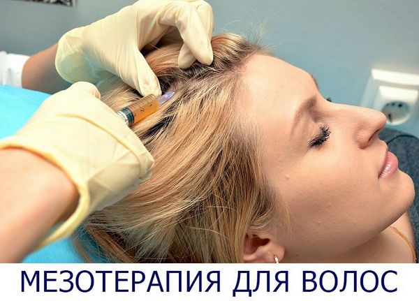 Мезотерапия для волос - процедура, препараты и фото до и после