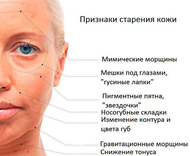 когда необходима круговая подтяжка лица