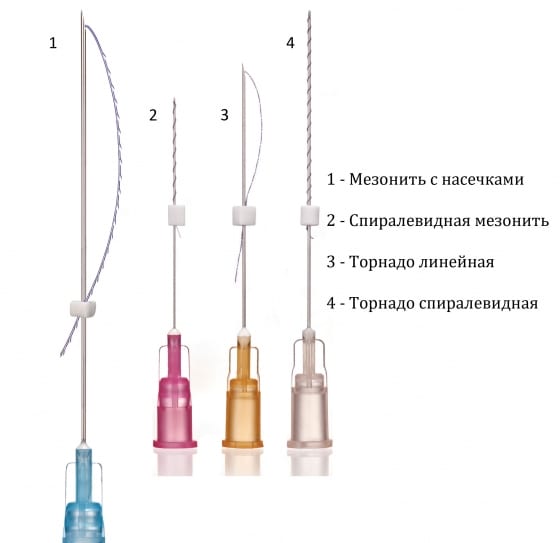 Мезонити для подтяжки груди