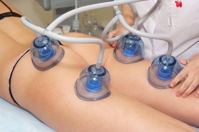 Антицеллюлитный лимфодренажный массаж вакуумным методом