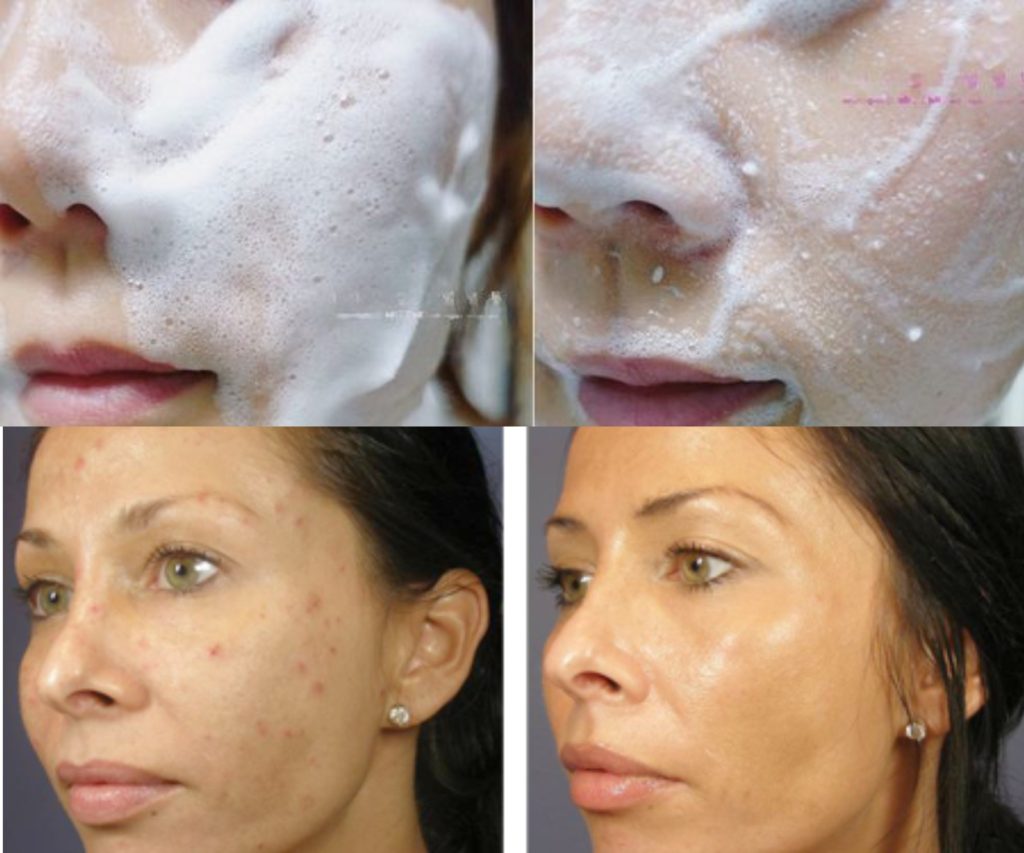 Пилинг-скатка для лица: быстрый и недорогой способ очистить кожу